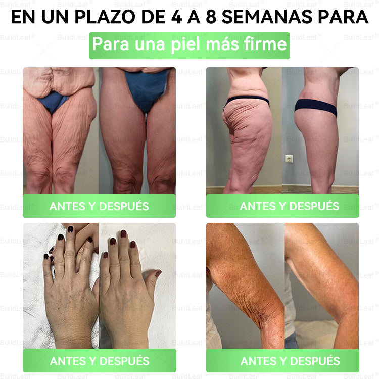 🍃𝖮𝖿𝖿𝗂𝖼𝗂𝖺𝗅 𝖲𝗍𝗈𝗋𝖾 |🍃 𝑩𝒖𝐢𝒍𝒅𝑳𝒆𝐚𝒇® GL𝐏-1 8 en1 𝙁𝙞𝙩 &amp; 𝙑𝙞𝙩𝙖𝙡 Solución Oral  (𝑱𝒖𝒔𝒕 𝒐𝒏𝒄𝒆 𝒂 𝒅𝒂𝒚, 𝒗𝒊𝒔𝒊𝒃𝒍𝒆 𝒄𝒉𝒂𝒏𝒈𝒆𝒔 𝒊𝒏 7 𝒅𝒂𝒚𝒔) ✅ 𝑭𝒐𝒓 𝒐𝒃𝒆𝒔𝒊𝒕𝒚, 𝒄𝒂𝒓𝒅𝒊𝒐𝒗𝒂𝒔𝒄𝒖𝒍𝒂𝒓 𝒉𝒆𝒂𝒍𝒕𝒉, 𝒅𝒊𝒂𝒃𝒆𝒕𝒆𝒔, 𝒔𝒍𝒆𝒆𝒑 𝒂𝒑𝒏𝒆𝒂, 𝒈𝒖𝒕 𝒉𝒆𝒂𝒍𝒕𝒉, 𝒋𝒐𝒊𝒏𝒕 𝒊𝒔𝒔𝒖𝒆𝒔, 𝒂𝒏𝒅 𝒎𝒐𝒓𝒆