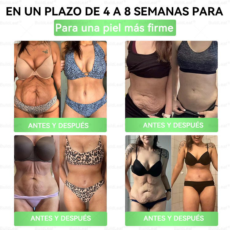 🍃𝖮𝖿𝖿𝗂𝖼𝗂𝖺𝗅 𝖲𝗍𝗈𝗋𝖾 |🍃 𝑩𝒖𝐢𝒍𝒅𝑳𝒆𝐚𝒇® GL𝐏-1 8 en1 𝙁𝙞𝙩 &amp; 𝙑𝙞𝙩𝙖𝙡 Solución Oral  (𝑱𝒖𝒔𝒕 𝒐𝒏𝒄𝒆 𝒂 𝒅𝒂𝒚, 𝒗𝒊𝒔𝒊𝒃𝒍𝒆 𝒄𝒉𝒂𝒏𝒈𝒆𝒔 𝒊𝒏 7 𝒅𝒂𝒚𝒔) ✅ 𝑭𝒐𝒓 𝒐𝒃𝒆𝒔𝒊𝒕𝒚, 𝒄𝒂𝒓𝒅𝒊𝒐𝒗𝒂𝒔𝒄𝒖𝒍𝒂𝒓 𝒉𝒆𝒂𝒍𝒕𝒉, 𝒅𝒊𝒂𝒃𝒆𝒕𝒆𝒔, 𝒔𝒍𝒆𝒆𝒑 𝒂𝒑𝒏𝒆𝒂, 𝒈𝒖𝒕 𝒉𝒆𝒂𝒍𝒕𝒉, 𝒋𝒐𝒊𝒏𝒕 𝒊𝒔𝒔𝒖𝒆𝒔, 𝒂𝒏𝒅 𝒎𝒐𝒓𝒆